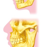 歯と顎関節